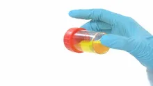 Scientist hand with tube